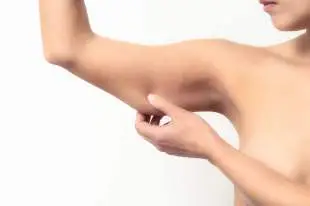 Arm lift surgery brachioplasty procedure for sagging arms in Istanbul