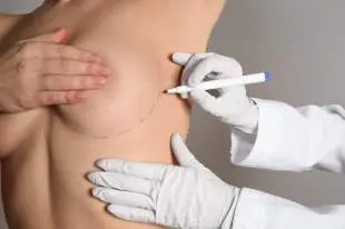 CHIRURGIE DES SEINS